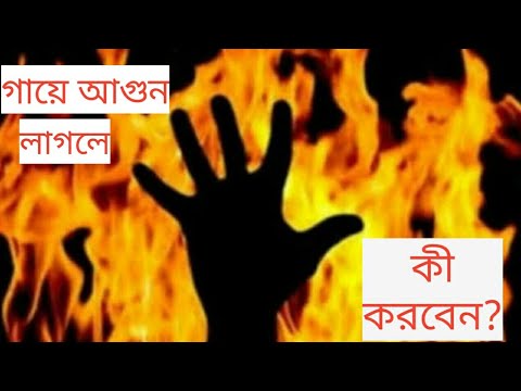 গায়ে আগুন লাগলে কী করবেন? Burn Tips || Dr. Gabinda || DMC || Munni || Anannya Online Channel.